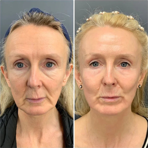 Margaret T., 56